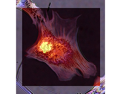 Entre dois mundos: “ver” para além da imagem ótica